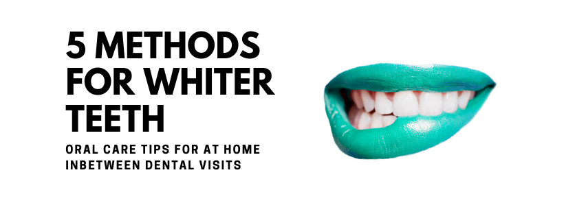 4 Methods For Whiter Teeth